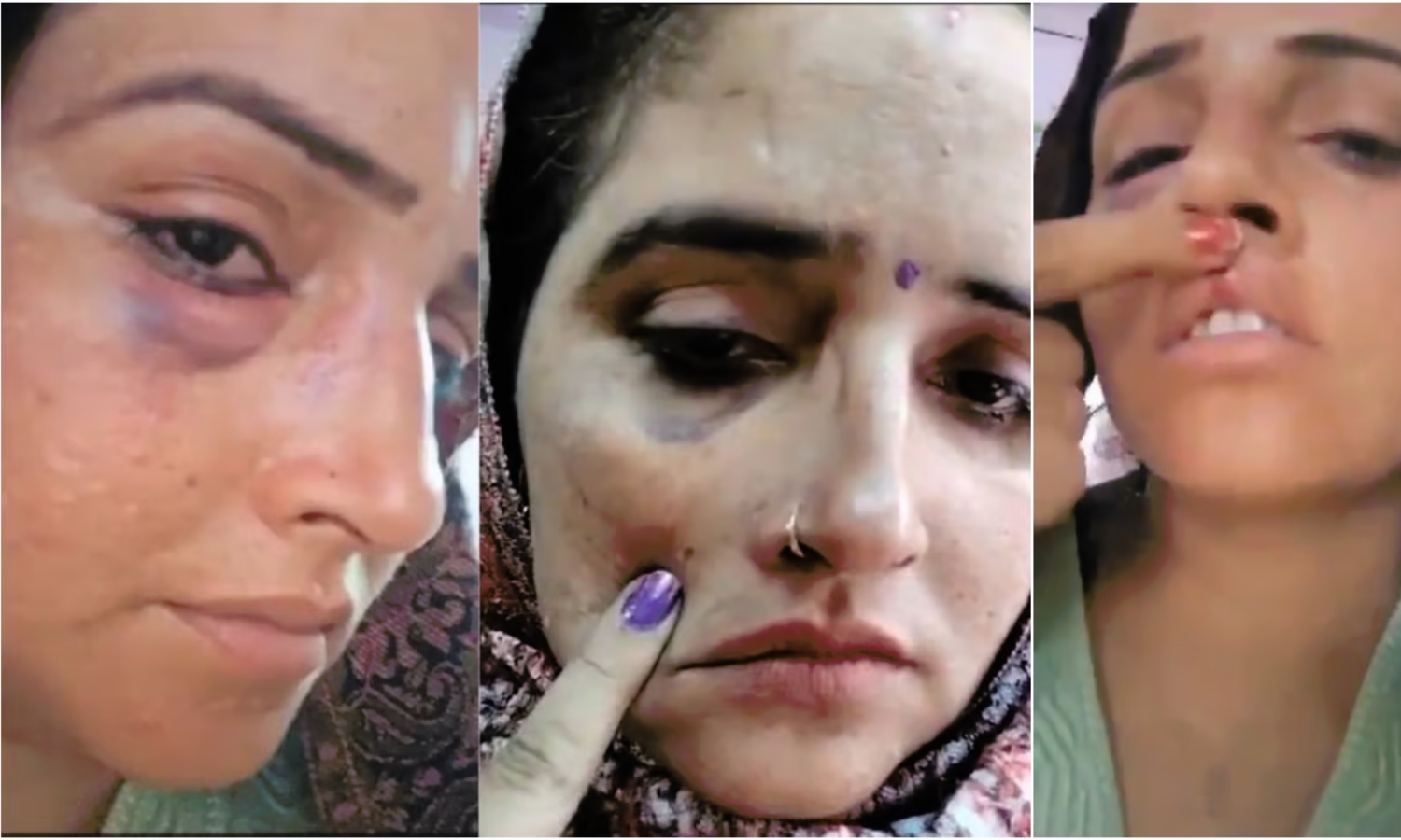 Lawyer Dismisses Viral Video Showing Seema Haider with Injuries as AI-Created Fake